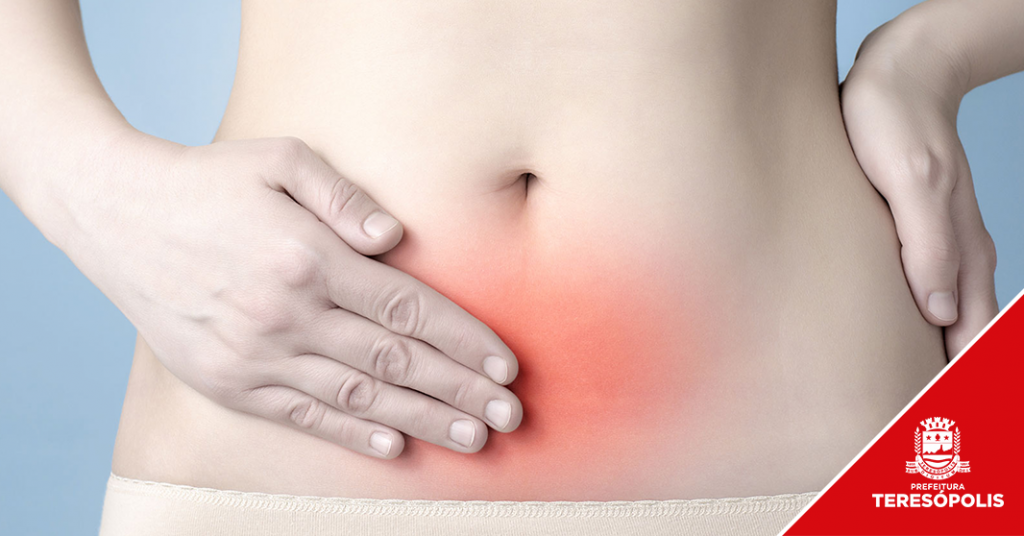 Saúde da mulher: Prefeitura de Teresópolis custeia cirurgias de Endometriose e coloca em dia a fila pelo procedimento